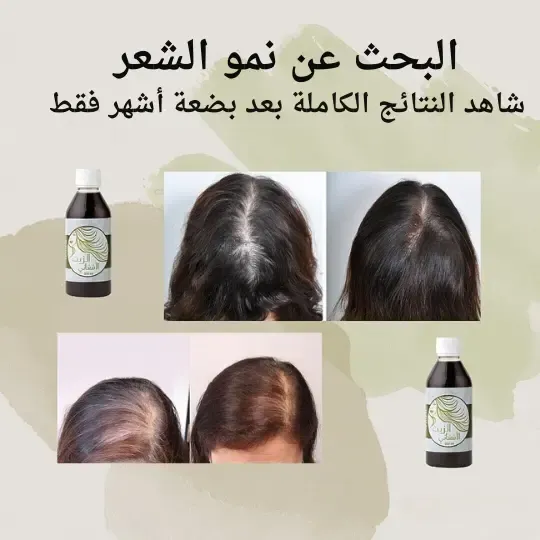 زيت تقوية وتطويل الشعر Afghan Oil product image