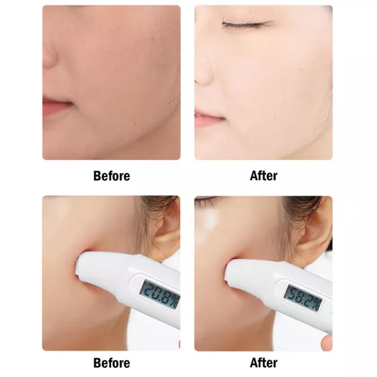 مزيل النمش لتبييض البشرة Freckle Remover For Skin Whitening product image
