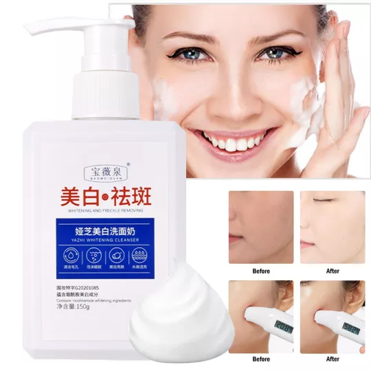 مزيل النمش لتبييض البشرة Freckle Remover For Skin Whitening product image