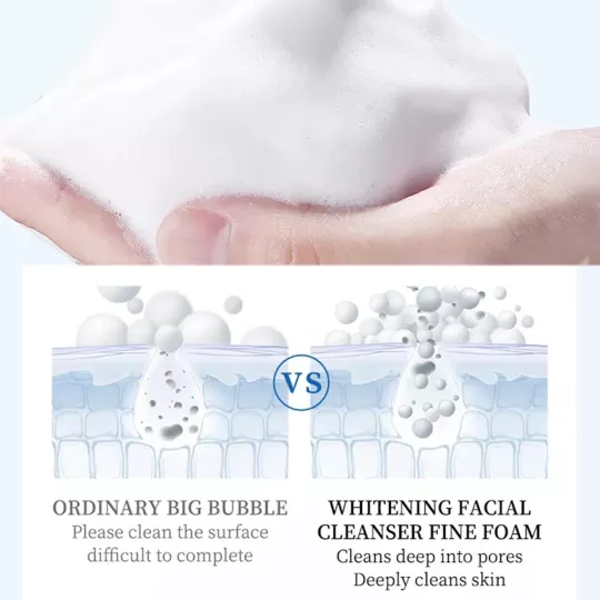 مزيل النمش لتبييض البشرة Freckle Remover For Skin Whitening product image
