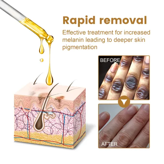سيروم للبقع الداكنة Jaysuing Therapy Drops product image