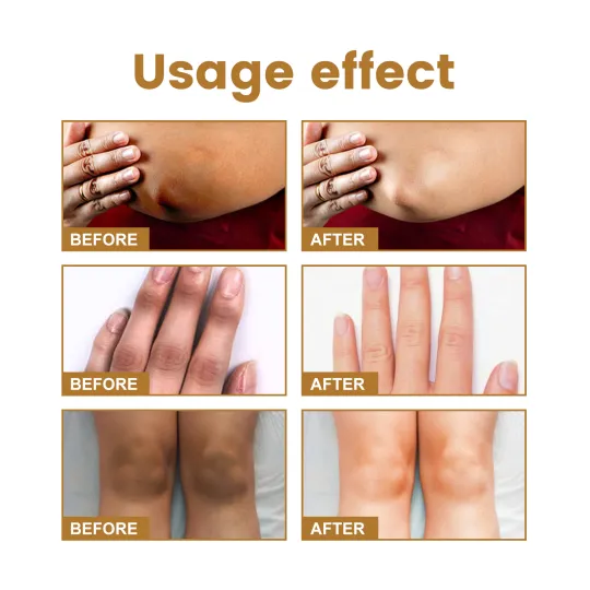 سيروم للبقع الداكنة Jaysuing Therapy Drops product image