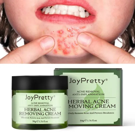 كريم ازالة حب الشباب Joy Pretty Herbal Acne Removing Cream product image