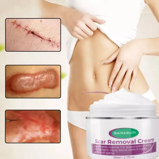 كريم إزالة الندبات Ouhoe Scar Removal Cream product image
