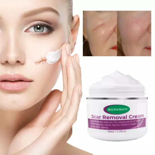 كريم إزالة الندبات Ouhoe Scar Removal Cream product image